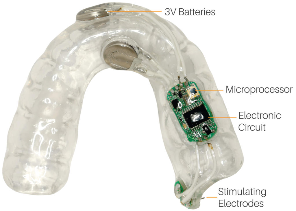 Thiết bị điện tử hỗ trợ cho bệnh nhân khô miệng nvchsare.com-intra oral electrostimulation device